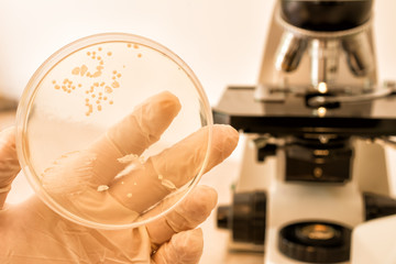 Scientist's hand holding a petri dish infected with fungus. Candida albicans fungus on petri dish