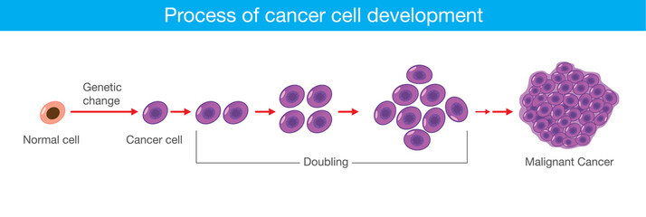 Process of cancer cell development. Medical illustration.