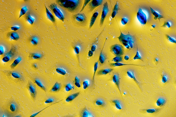 PC-3 human prostate cancer cells