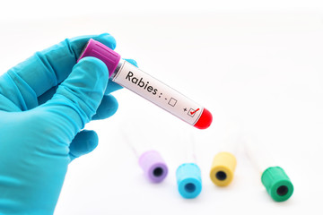 Rabies virus positive