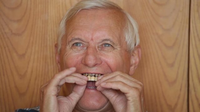 Senior man taking out denture opening mouth and showing his teeth.