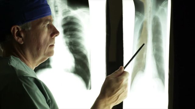 A mature male doctor looking at an x-ray displayed on an illuminator panel in a dark room.