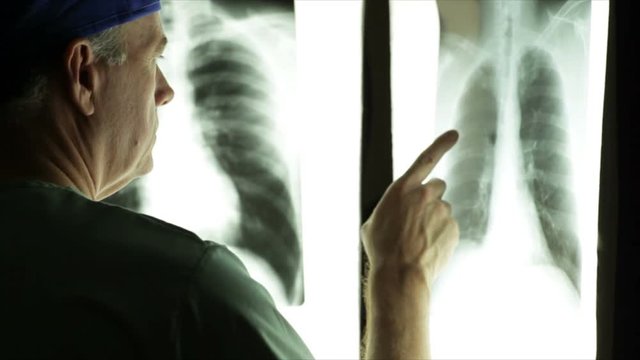 A mature male doctor in a dark room comparing x-rays displayed on illuminator panels.