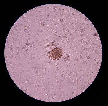 Unfertilized  Ascaris lumbricoides egg.