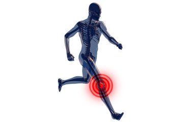 Knee Pain in Human Body Transparent Design