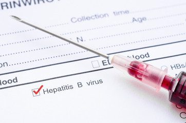 Fototapeta premium Red mark on Hepatitis B screening test form.