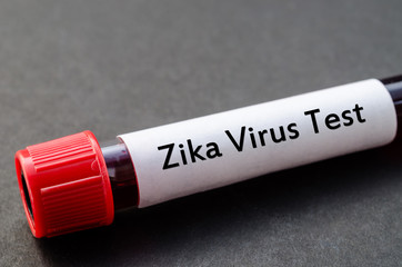 Zika virus test concept.