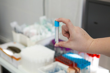 tubes reagents in the hands of women