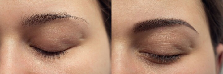 Perfect Eyebrows Before After