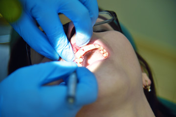 Dentist making teeth