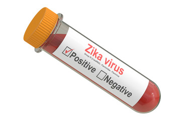 Test tube with blood sample positive with Zika virus, 3D renderi