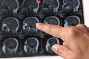 doctors hand with radiography of head