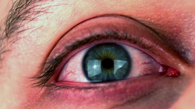 Closeup Of A Disgusting Eye
