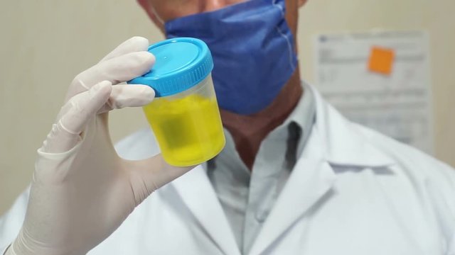 Anonymous male laboratory technician agitates and visually inspects the contents of a urine sample cup.