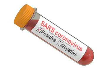Test tube with blood sample positive SARS coronavirus, 3D render