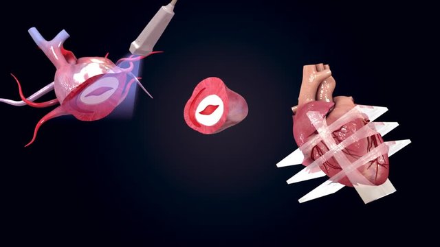 Echocardiography