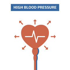 Blood pressure concept