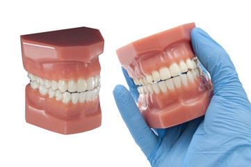 dental mould with invisible orthodontic removable aligners for te