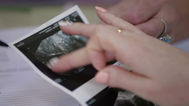 Medical ultrasound scan of human embryo