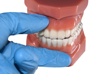 dental mould with invisible removable aligners orthodontic 