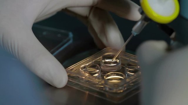 Storing frozen eggs sperm in box liquid nitrogen
