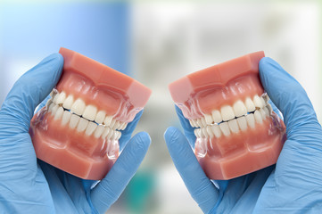 dentist hand show dental mould smiling isolated on white