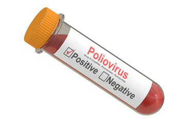 Test tube with blood sample positive poliovirus, 3D rendering
