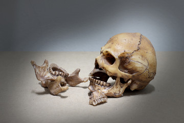 tooth with caries , Broken teeth human skull on wood background. - still life.