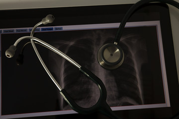 Stethoscope on Xray photo