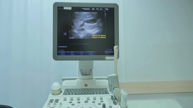 Ultrasound scanner