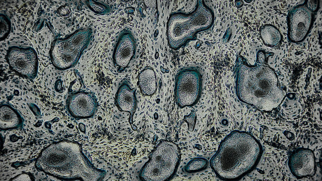 menschliche Zellen unter dem Mikroskop - Anatomie / Histologie / Pathologie
