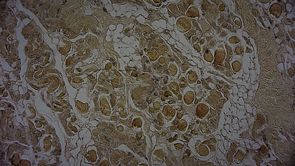 menschliche Zellen unter dem Mikroskop - Anatomie / Histologie / Pathologie