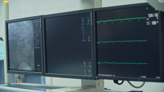 Close-up of three monitors in operating room, shot on Sony NEX 700 + Odyssey 7Q
