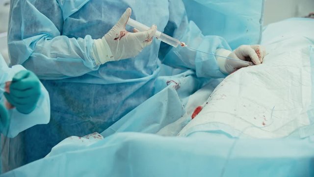 Surgeon performing coronary artery bypass graft surgery assisted by nurse, close-up shot on Sony NEX 700 + Odyssey 7Q