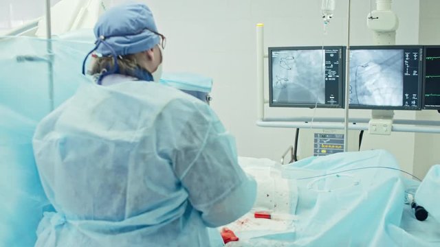 Rear view of female surgeon looking at monitors while performing coronary artery bypass surgery assisted by nurse in modern operating room, shot on Sony NEX 700 + Odyssey 7Q