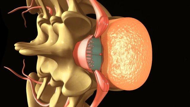 Spinal & Epidural anaesthesia