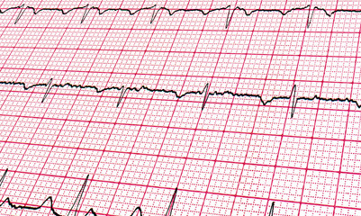 Cardiogram. Background