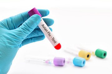 Blood for Avian Flu test