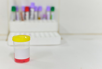 Urine sample bottle