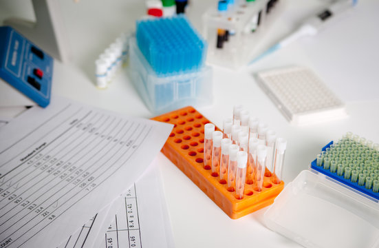 desktop laboratory medical equipment for blood tests and the results of cbc