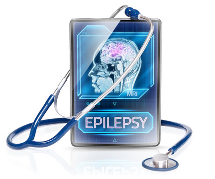 Diagnosis of epilepsy