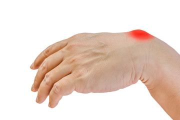 Ganglion cyst