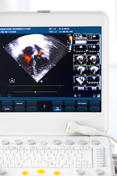 modern ultrasound machine
