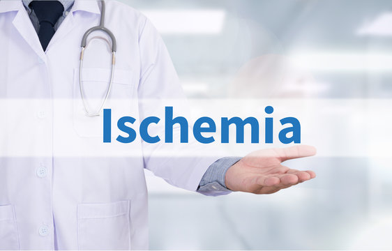 Ischemia