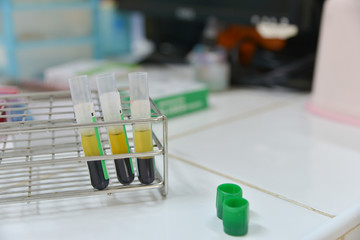 Close up plasma in test tube