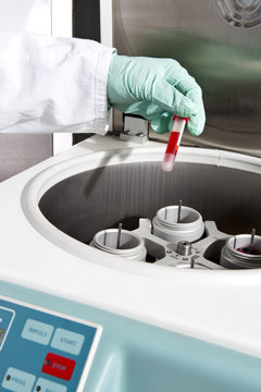 A lab technician putting a vial of blood into a centrifuge, close-up of hand
