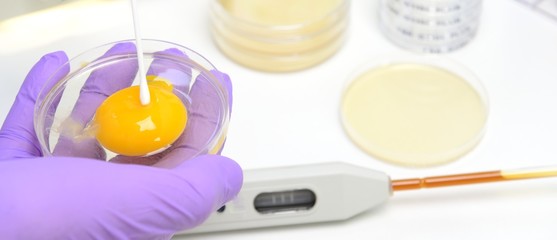 Lebensmittelkontrolle  im Labor Hygiene Ei Salmonellen