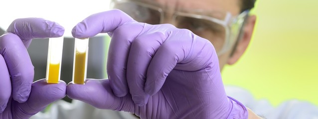 Lebensmittelkontrolle  im Labor Hygiene Ei Salmonellen