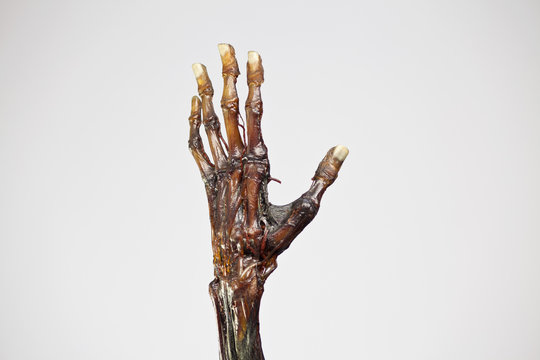 An anatomical model of a mummified human hand