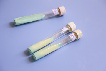 antivirus, virus, tuberculosis testing and analysis, Tajikistan